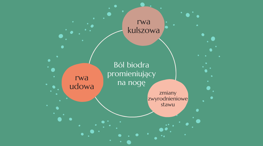 ból biodra promieniujący na nogę - przyczyny