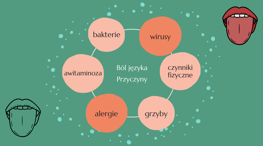 ból języka - przyczyny