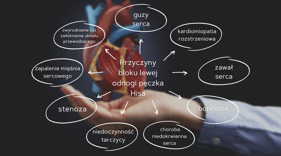 blok lewej odnogi pęczka hisa - przyczyny