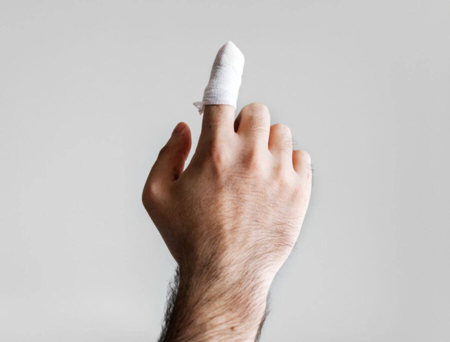 Dowiedz się, ile zwolnienia po amputacji palca możesz otrzymać?